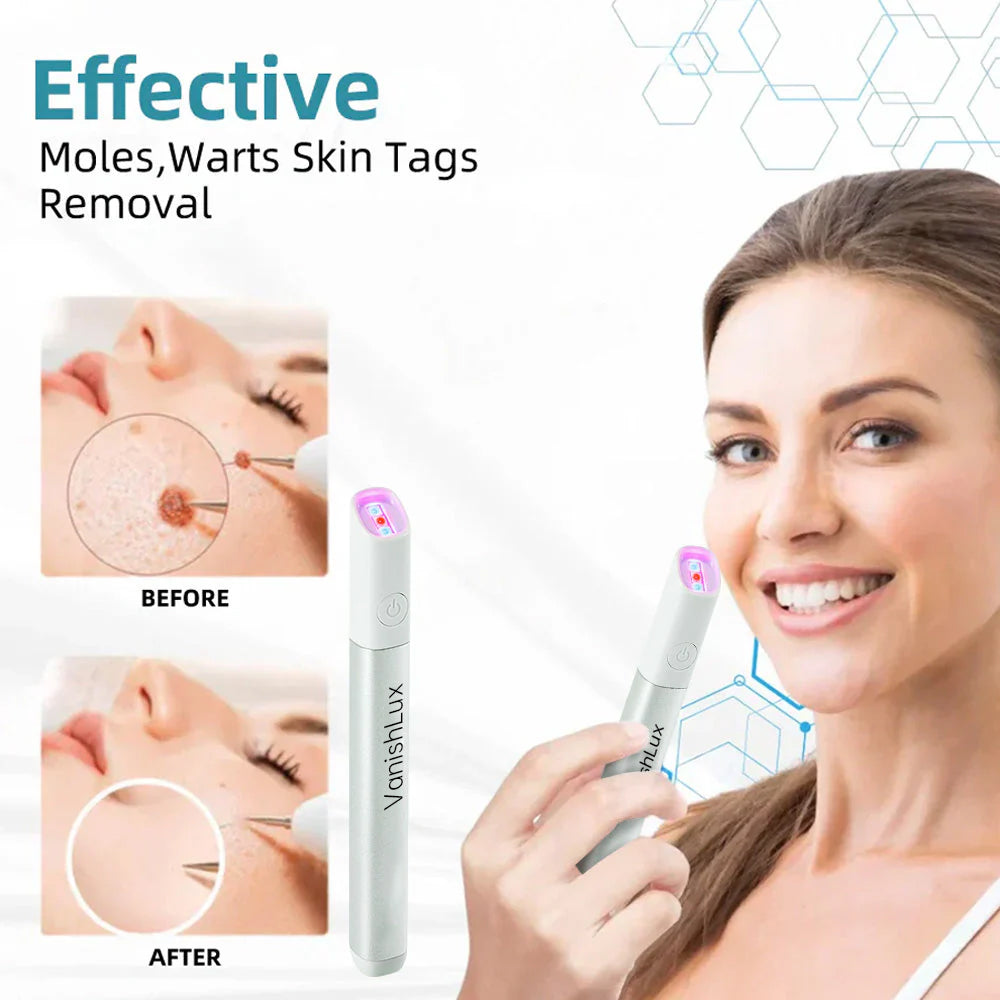 🇨🇦 Bikenda® VanishLux All-in-One Laser Eraser Pen(Powered by CO₂ laser technology – effectively removes moles, warts, skin tags, pigmentation spots, and other skin imperfections)