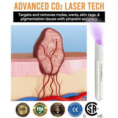 🇨🇦 Bikenda® VanishLux All-in-One Laser Eraser Pen(Powered by CO₂ laser technology – effectively removes moles, warts, skin tags, pigmentation spots, and other skin imperfections)