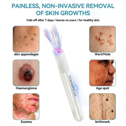 🇨🇦 Bikenda® VanishLux All-in-One Laser Eraser Pen(Powered by CO₂ laser technology – effectively removes moles, warts, skin tags, pigmentation spots, and other skin imperfections)