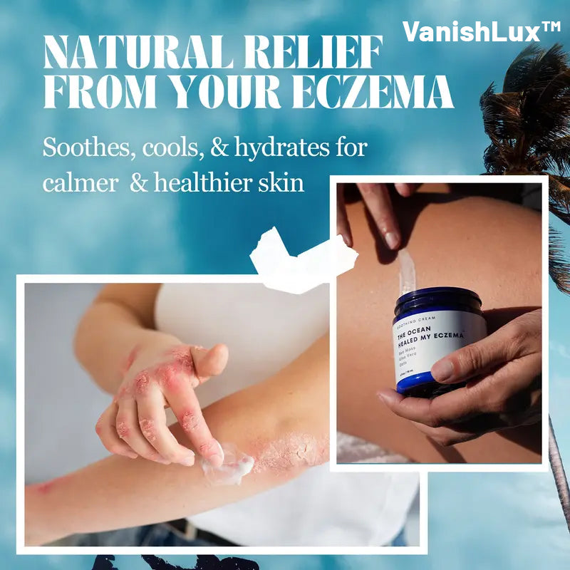 Natural Soothing Cream with Sea Moss & Oats - Eczema & Psoriasis Relief - Ocean Minerals - for Sensitive Skin - Hydrating Eczema Cream for Dry Skin